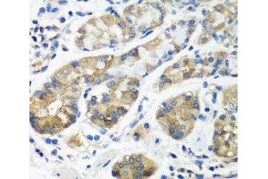 Immunohistochemistry of paraffin-embedded Human stomach using STX16 Polyclonal Antibody at dilution of 1:100 (40x lens). (Syntaxin 16 anticorps)