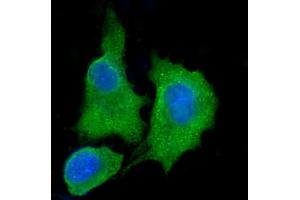 IF analysis of ALDH3A1 using anti-ALDH3A1 antibody (ABIN7601680).