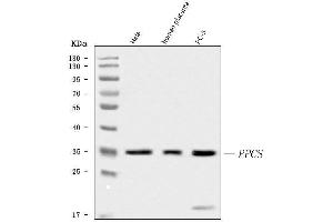 Western blot analysis of PPCS using anti-PPCS antibody (ABIN6719631). (PPCS anticorps)