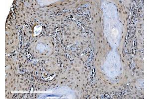 IHC analysis of DDX1 using anti-DDX1 antibody (ABIN7602051).
