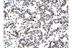 anti-Zinc Finger Protein 385A (ZNF385A) (N-Term) antibody