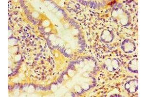 Immunohistochemistry of paraffin-embedded human small intestine tissue using ABIN7158861 at dilution of 1:100