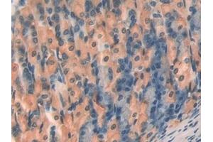 Detection of TBG in Mouse Stomach Tissue using Polyclonal Antibody to Thyroxine Binding Globulin (TBG)