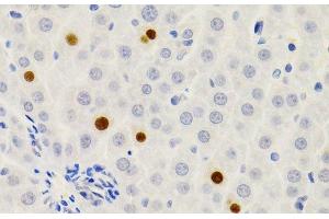 Immunohistochemistry of paraffin-embedded Rat liver using GEMIN2 Polyclonal Antibody at dilution of 1:200 (40x lens). (SIP1 anticorps)