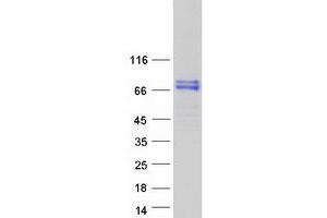 Validation with Western Blot (C4BPA Protein (Myc-DYKDDDDK Tag))