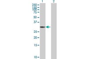 Western Blot analysis of ANXA4 expression in transfected 293T cell line by ANXA4 MaxPab polyclonal antibody. (Annexin IV anticorps  (AA 1-321))