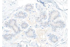 Immunohistochemistry (IHC) image for anti-Signal Transducer and Activator of Transcription 5B (STAT5B) (AA 737-787) antibody (ABIN7455110) (Recombinant STAT5B anticorps  (AA 737-787))