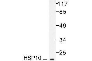 Image no. 1 for anti-Heat Shock 10kDa Protein 1 (Chaperonin 10) (HSPE1) antibody (ABIN265468) (HSPE1 anticorps)