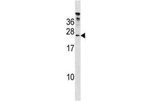 HTATSF1 antibody western blot analysis in 293 lysate. (HTATSF1 anticorps  (AA 152-179))