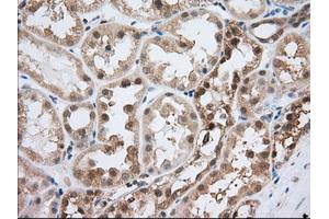 Image no. 9 for anti-Acetyl-CoA Acetyltransferase 2 (ACAT2) antibody (ABIN1496403) (ACAT2 anticorps)