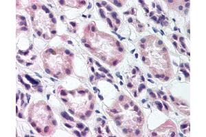 Image no. 1 for anti-Ras Responsive Element Binding Protein 1 (RREB1) antibody (ABIN302671)