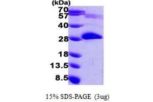 SDS-PAGE (SDS) image for Pyridoxamine 5'-Phosphate Oxidase (PNPO) (AA 57-261) protein (His tag) (ABIN667278) (PNPO Protein (AA 57-261) (His tag))
