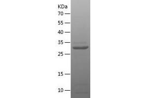 Western Blotting (WB) image for Hypoxia Inducible Factor 1, alpha Subunit (Basic Helix-Loop-Helix Transcription Factor) (HIF1A) (AA 575-825) protein (His tag) (ABIN7123398)