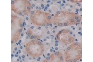 IHC-P analysis of kidney tissue, with DAB staining. (TMOD3 anticorps  (AA 1-352))