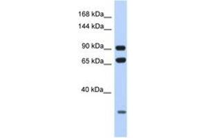 Image no. 1 for anti-Armadillo Repeat Containing 4 (ARMC4) (AA 60-109) antibody (ABIN6748050) (ARMC4 anticorps  (AA 60-109))