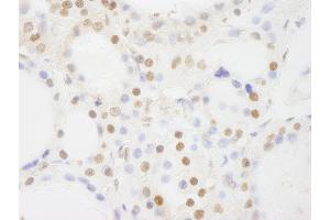 Immunohistochemistry (IHC) image for anti-BRF1, RNA polymerase III transcription initiation factor subunit (BRF1) (AA 627-677) antibody (ABIN7448445)