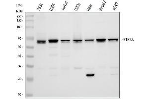 Western blot analysis of STK33 using anti-STK33 antibody (ABIN7606402).