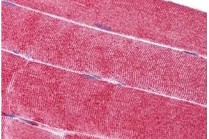 Human Skeletal Muscle: Formalin-Fixed, Paraffin-Embedded (FFPE)