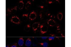 Confocal immunofluorescence analysis of HeLa cells using USO1 Polyclonal Antibody at dilution of 1:50. (USO1 anticorps)