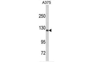 Western blot analysis of DSC1 Antibody (C-term) in A375 cell line lysates (35ug/lane).