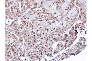 IHC-P Image Immunohistochemical analysis of paraffin-embedded Cal27 xenograft, using Annexin A1, antibody at 1:500 dilution. (Annexin a1 anticorps)
