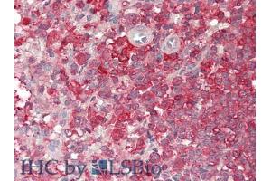 IHC-P analysis of Human Spleen Tissue, with HE staining. (PCSK9 anticorps  (AA 454-679))