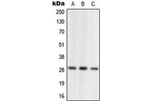 Western blot analysis of NRL expression in HEK293T (A), SP2/0 (B), PC12 (C) whole cell lysates. (NRL anticorps  (N-Term))