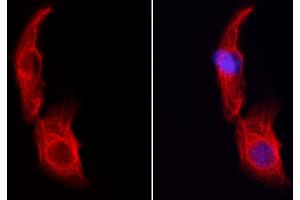ABIN6259540 and ABIN6274453 staining HeLa cells by IF/ICC.