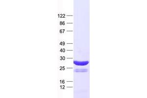 Validation with Western Blot