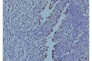IHC analysis of EIF4A1 using anti-EIF4A1 antibody (ABIN7603144). (EIF4A1 anticorps  (N-Term))