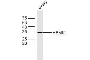 Mouse ovary lysates probed with HEMK1 Polyclonal Antibody, Unconjugated  at 1:300 dilution and 4˚C overnight incubation. (HEMK1 anticorps  (AA 21-120))