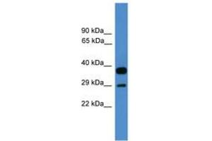 Image no. 1 for anti-OTU Domain, Ubiquitin Aldehyde Binding 2 (OTUB2) (AA 91-140) antibody (ABIN6745385) (OTUB2 anticorps  (AA 91-140))