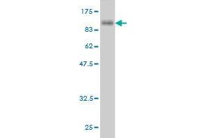 Western Blot detection against Immunogen (95.