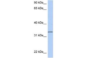 WB Suggested Anti-C3orf62 Antibody Titration: 0. (C3orf62 anticorps  (Middle Region))