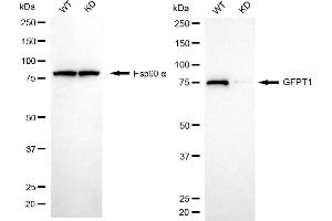 Western blotting analysis using GFPT1 antibody (ABIN7798748). (Recombinant GFPT1 anticorps)