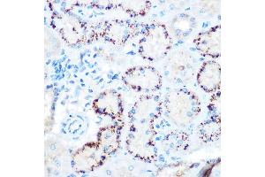 Immunohistochemistry of paraffin-embedded rat kidney using  Rabbit pAb (ABIN3015826, ABIN3015827, ABIN3015828 and ABIN6219178) at dilution of 1:100 (40x lens). (ANGPTL4 anticorps  (AA 26-406))