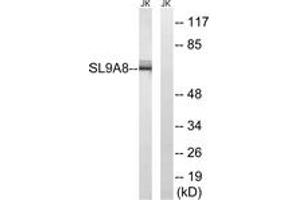 Western Blotting (WB) image for anti-Solute Carrier Family 9 (Sodium/hydrogen Exchanger), Member 8 (SLC9A8) (AA 451-500) antibody (ABIN2890644) (NHE8 anticorps  (AA 451-500))
