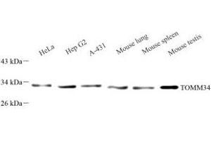 Western blot analysis of TOMM34 (ABIN7075984) at dilution of 1: 1000