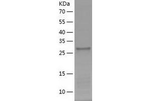 Western Blotting (WB) image for Pleckstrin Homology Domain Containing, Family A (Phosphoinositide Binding Specific) Member 8 (PLEKHA8) (AA 122-400) protein (His-IF2DI Tag) (ABIN7124484)