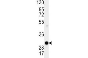 Western blot analysis of Cyclin D1 antibody and mouse lung lysate.