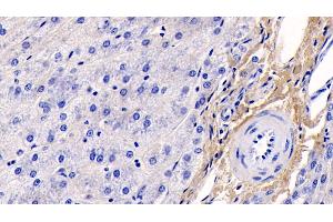 Detection of COL1a1 in Human Liver Tissue using Monoclonal Antibody to Collagen Type I Alpha 1 (COL1a1)