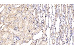 Detection of dLL4 in Rat Kidney Tissue using Polyclonal Antibody to Delta Like Protein 4 (dLL4)