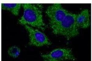 Anti-Rab2S Ab at 1/1,000 dilution, HEK293 cells transfected With GFP-Rab25, rabbit polyclonal to goat lµg (HRP) at 1/10,000 dilution, (RAB25 anticorps  (C-Term))