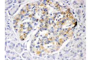 ISG15 was detected in paraffin-embedded sections of human pancreatic cancer tissues using rabbit anti- ISG15 Antigen Affinity purified polyclonal antibody (Catalog # ) at 1 µg/mL.