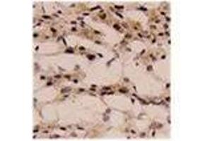 Image no. 1 for anti-Interleukin 1, beta (IL1B) (AA 118-269) antibody (ABIN791567)