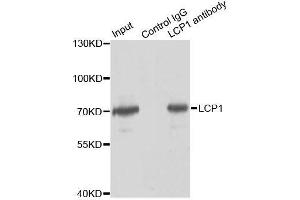 Immunoprecipitation analysis of 150ug extracts of Jurkat cells using 3ug LCP1 antibody. (LCP1 anticorps  (AA 1-270))