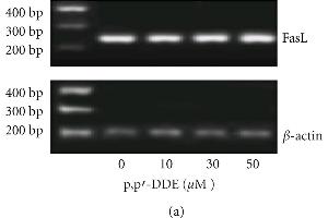 Effects of different p,p'-DDE concentrations on the FasL and caspase-3 and -8 mRNA in rat Sertoli cells by RT-PCR (a)-(c). (FASL anticorps  (AA 196-281))