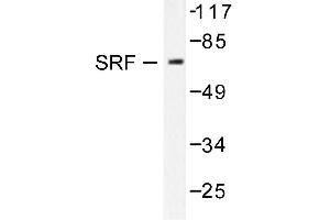 Image no. 1 for anti-Serum Response Factor (SRF) antibody (ABIN271823) (SRF anticorps)