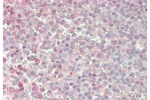 Immunohistochemistry with Spleen cell lysate tissue