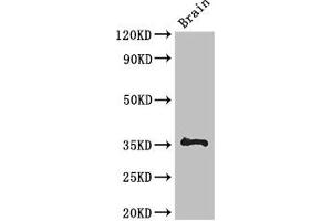 Western Blot Positive WB detected in: Mouse brain tissue All lanes: NPL antibody at 3 μg/mL Secondary Goat polyclonal to rabbit IgG at 1/50000 dilution Predicted band size: 36, 34, 32, 27, 13 kDa Observed band size: 36 kDa (NPL anticorps  (AA 17-77))